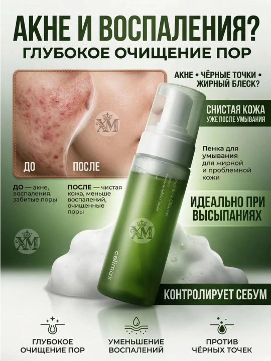Пенка для умывания, Real Noni Acne Bubble Cleanser, 155 мл - 