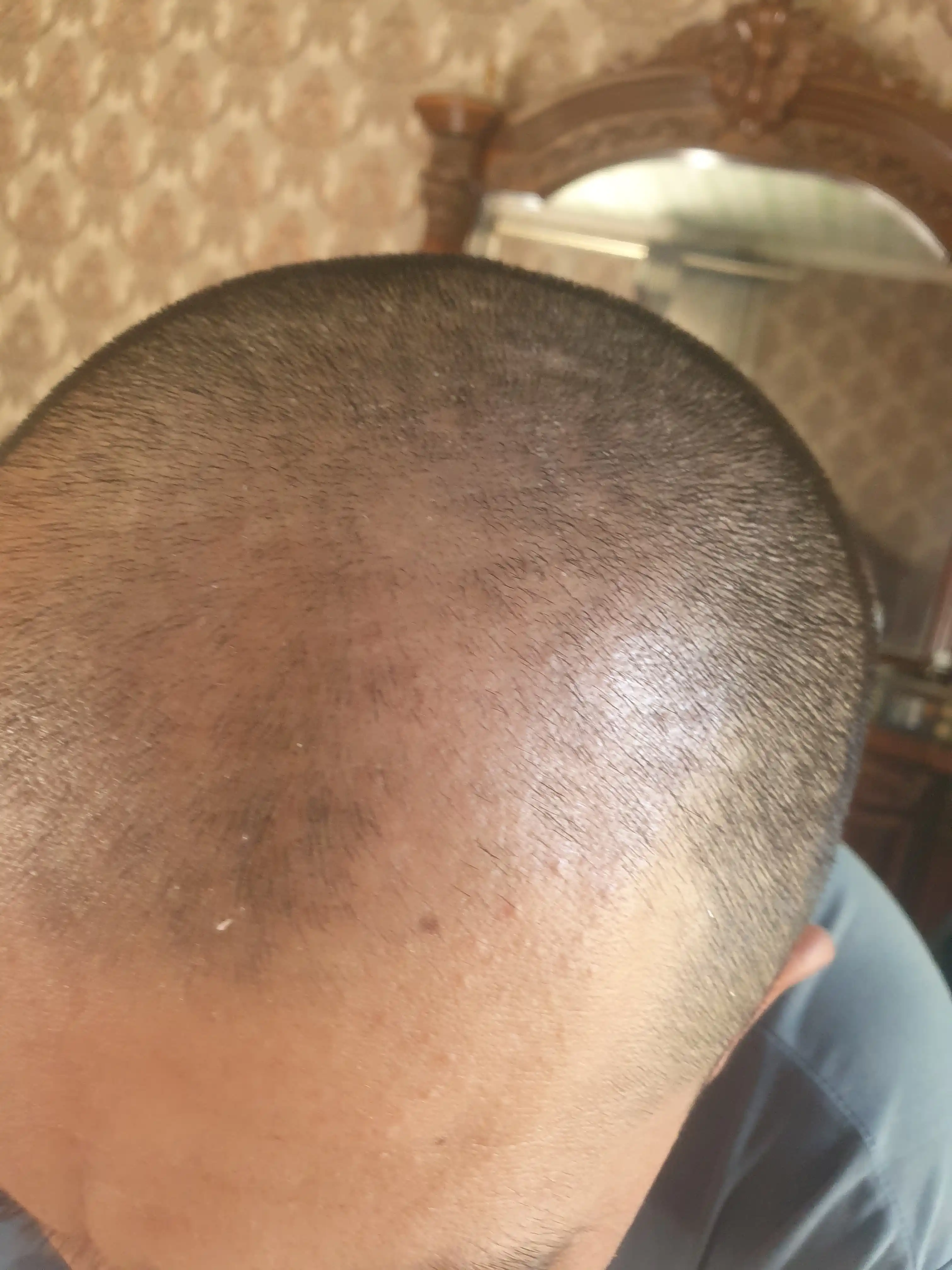 Soch va soqol o'stirish uchun minoksidil Kirkland Minoxidil 5%, 60 ml