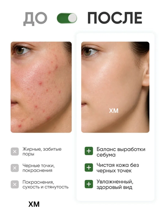 Сыворотки для лица от Anua омолаживающие увлажняющие питательные