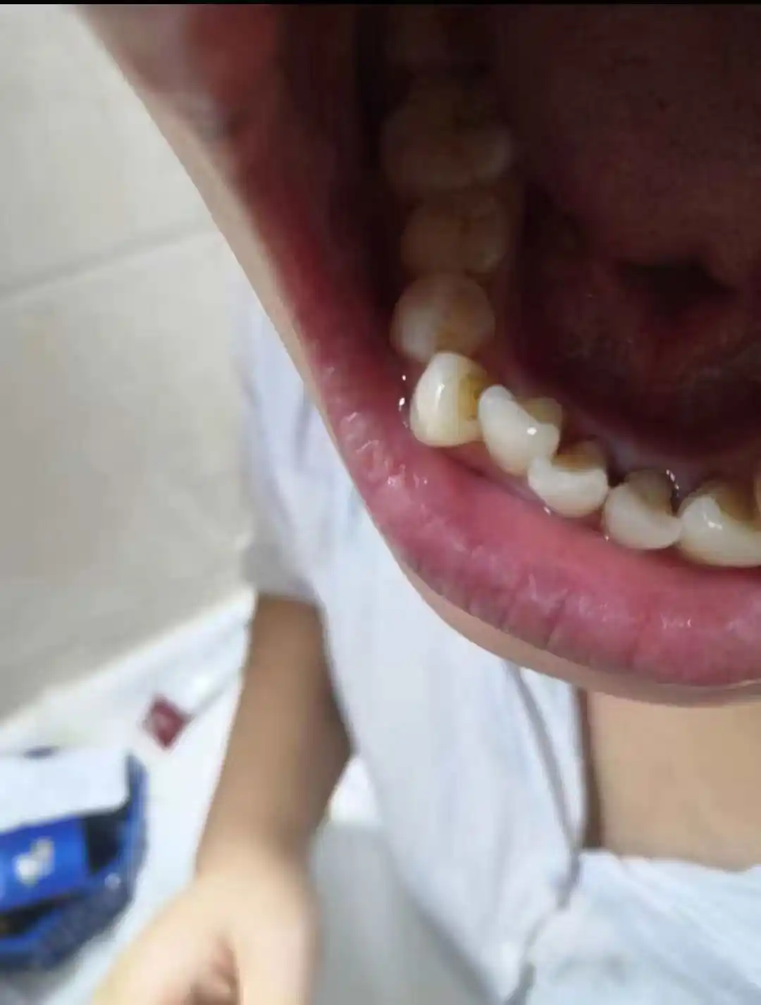 LYDIMOON probiotikli oqartiruvchi tish pastasi, yasemin, nafasni yangilaydi, 120 g