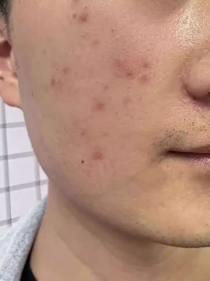 LYDIMOON Erkaklar uchun nemlendirici yuz kremi, 50 ml