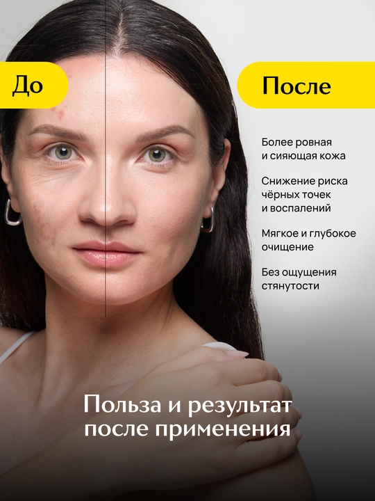 LABA Vitamin C ekssfoliatsiya qiluvchi piling-skatka, 100 ml