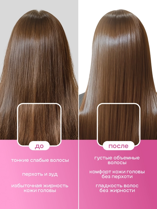 Barcha turdagi sochlar uchun shampun Medicube Rosemary PDRN Cooling Thickening Shampoo