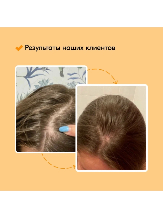 Лосьон, сыворотка против выпадения волос Zhangguang Fabao Фабао 101B Hair Tonic, 120 мл
