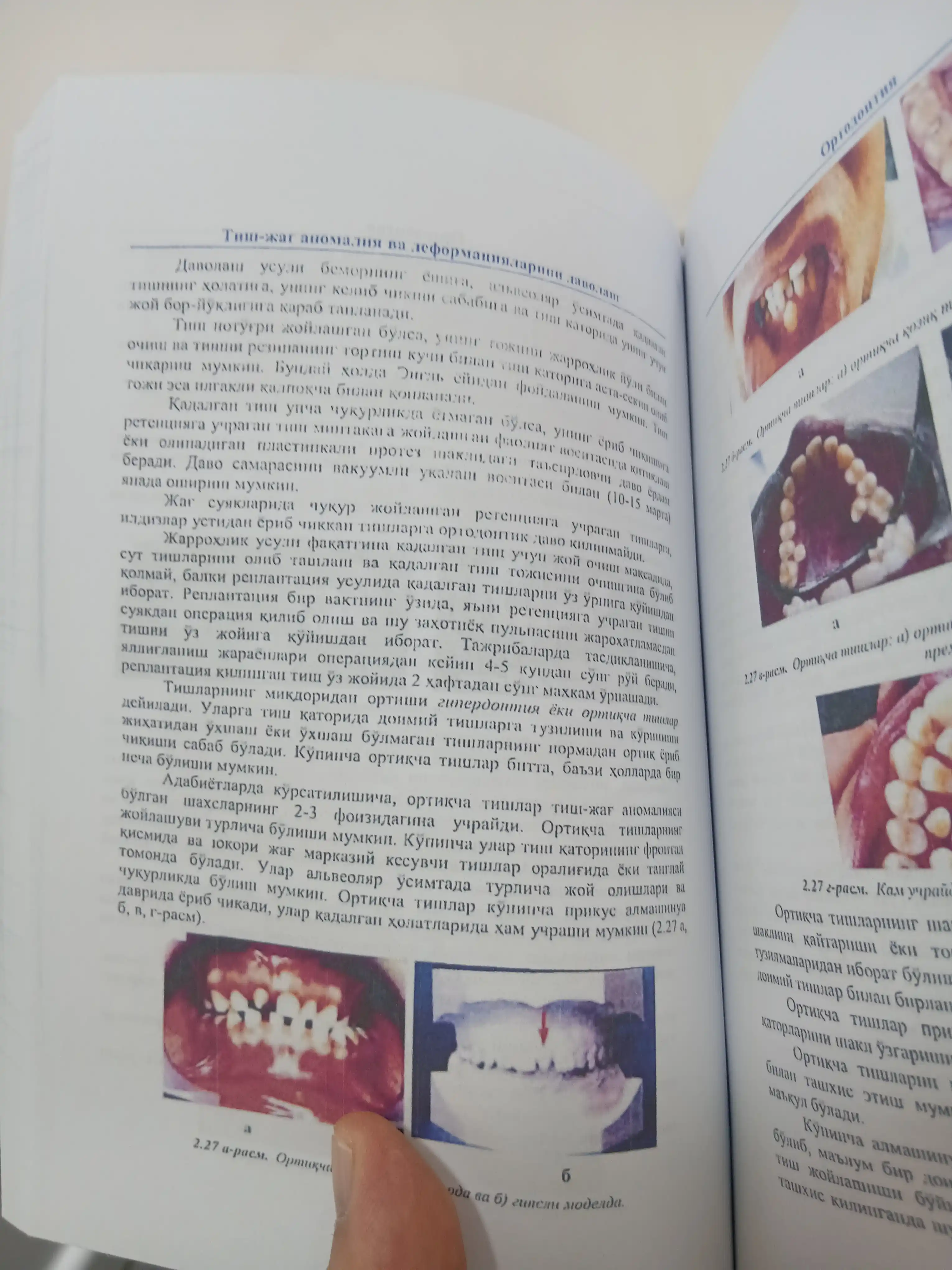 Ортодонтия — лечение зубочелюстных аномалий, учебное пособие