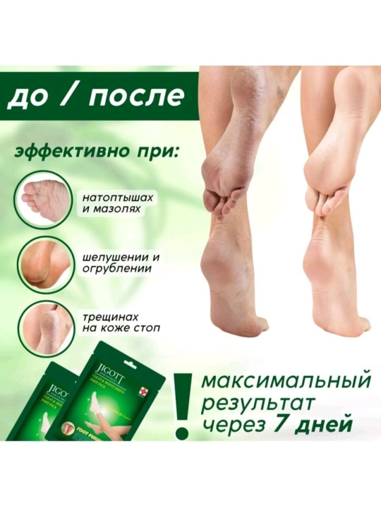 Jigott pedikyurli piling paypoqcha oyoqlar uchun niqob