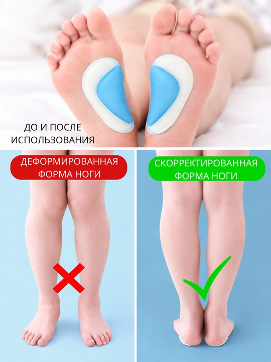 Детские ортопедические стельки для поддержки свода стопы