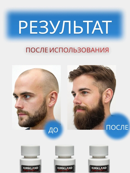Kirkland Minoxidil 5% (60 мл) для роста волос и бороды
