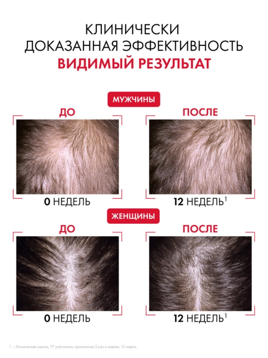 Сыворотка для волос Vichy Dercos Aminexil Regen, 90 мл