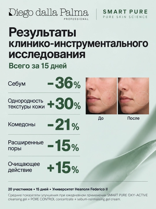 Sebumni me’yorlashtiruvchi gel-krem Diego dalla Palma Professional SMART PURE