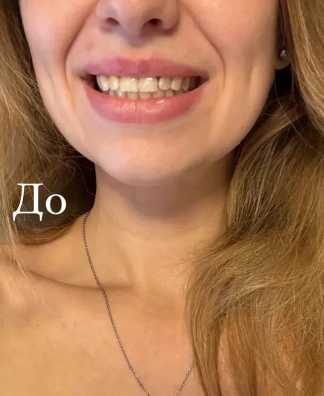Зубная паста LYDIMOON. Отбеливающая флакон 100 мл