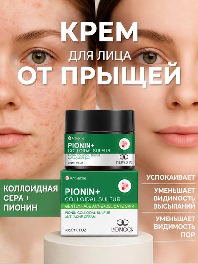 Крем для лица от прыщей и чёрных точек, коллоидная сера и азелаиновая кислота, 30 г - 