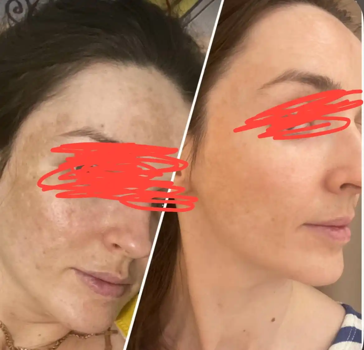 Arencia Vitamin C Booster Shot осветляющий крем бустер с витамином С и ниациномидом