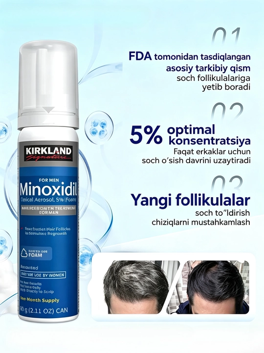 Kirkland Minoxidil 5% (60 мл) для роста волос и бороды