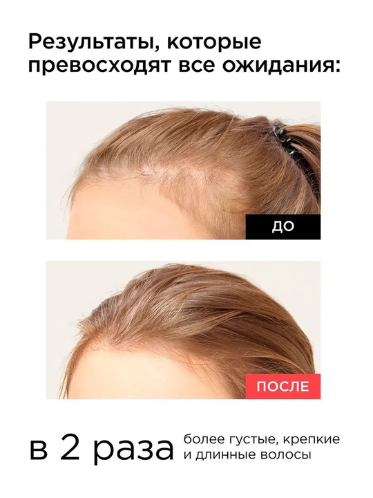MIXIT Grow Pro скраб для кожи головы очищающий 200 мл