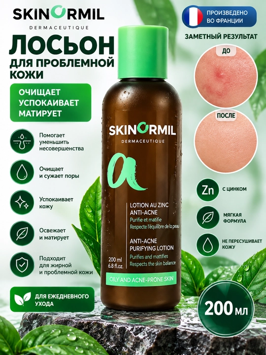 Лосьон для проблемной и жирной кожи ANTI-ACNE Anti-acne Purifying Lotion, 15 и 200 мл
