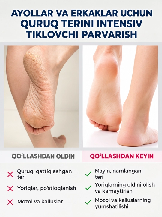 Крем для ног Pharmacos PANTHENOL UREA 75мл, Витэкс
