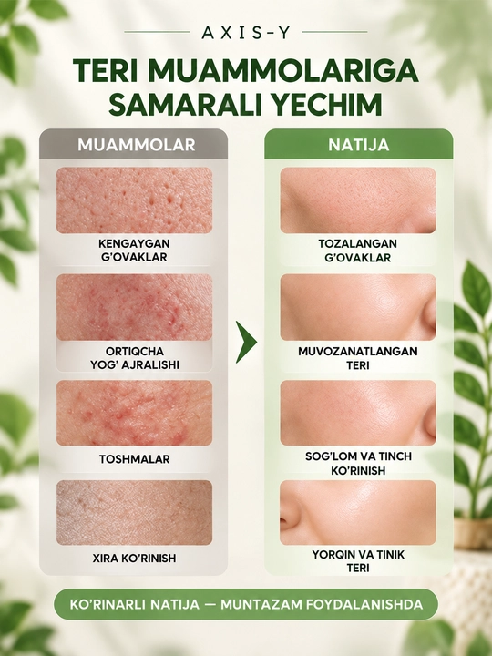 Yuz niqoblari, maska, qora nuqtalarga, ugri, xusnbuzar, ASIX-Y mask