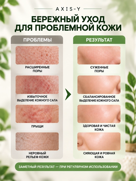 Yuz niqoblari, maska, qora nuqtalarga, ugri, xusnbuzar, ASIX-Y mask