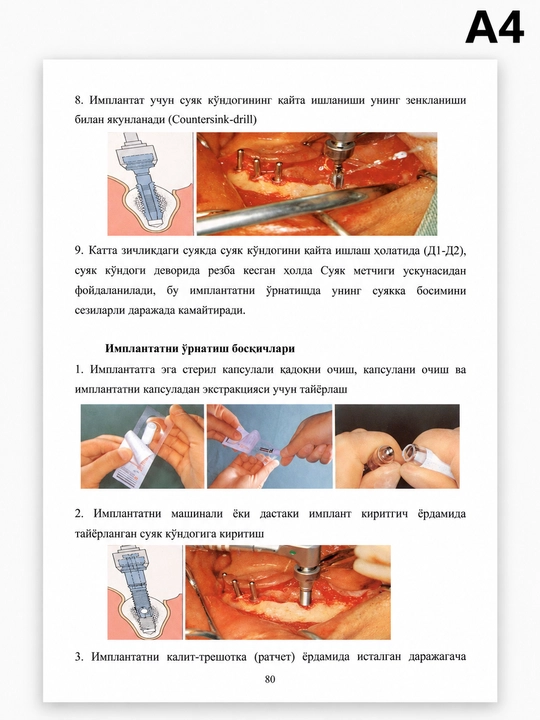 Основы дентальной имплантологии