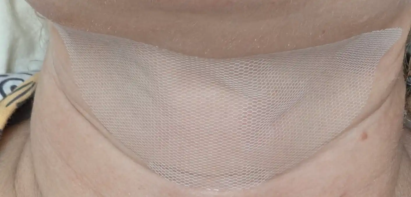 Bo‘yin uchun PDRNli eruvchan kollagen patchilar Anua PDRN Collagen Melting Patch For Neck