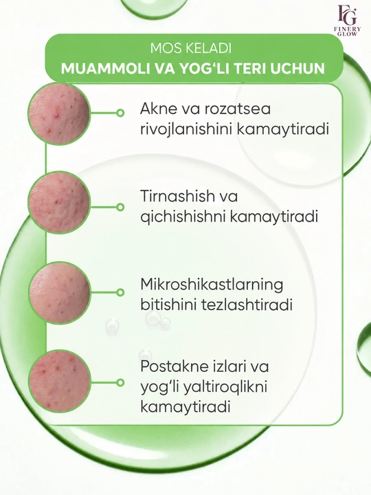 Anua Azelaic Acid 10% gialuronli tinchlantiruvchi yuz serumi, 30 ml
