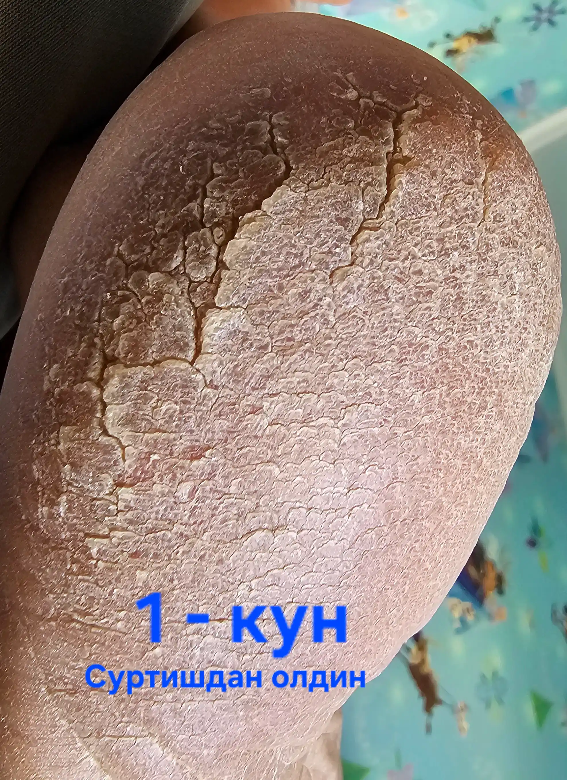 Крем мазь для пяток, рук, ног, лица, увлажняет и заживляет трещин на коже, ANTI-CRACK 20гр