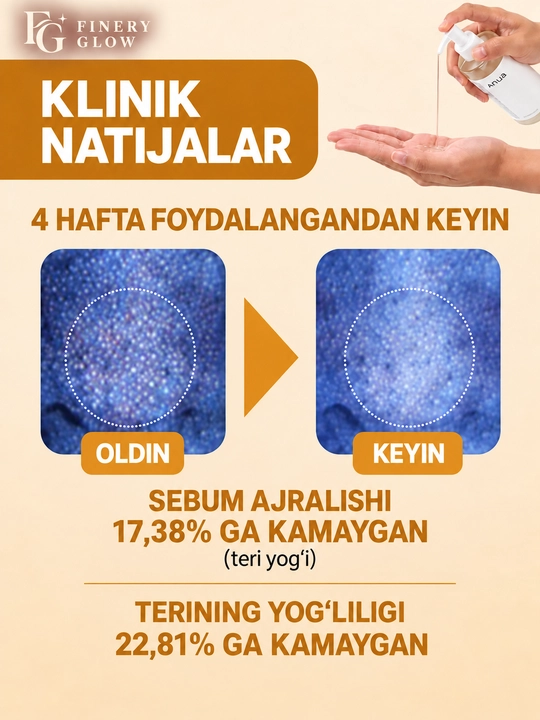 ANUA Heartleaf yuz va teshikchalarni tozalovchi gidrofil moy, 200 ml