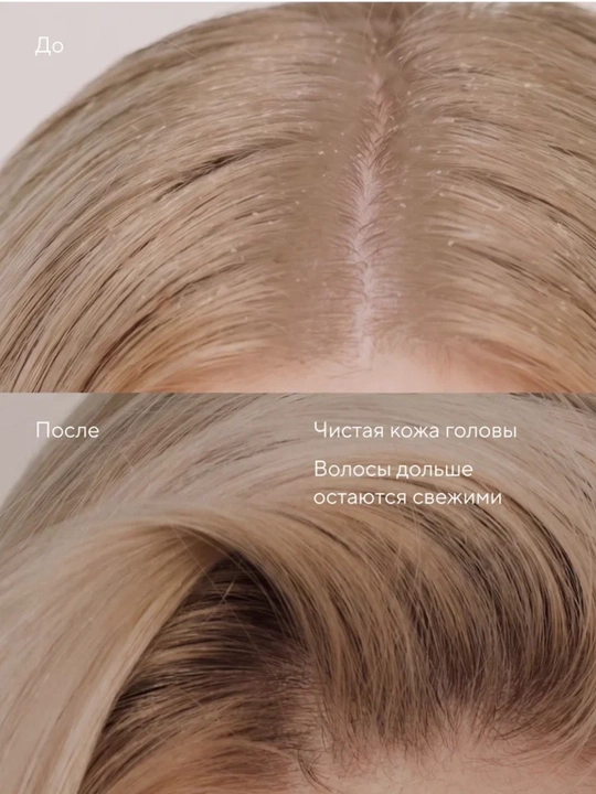 Шампунь для интенсивного очищения кожи головы EDERRA PURE