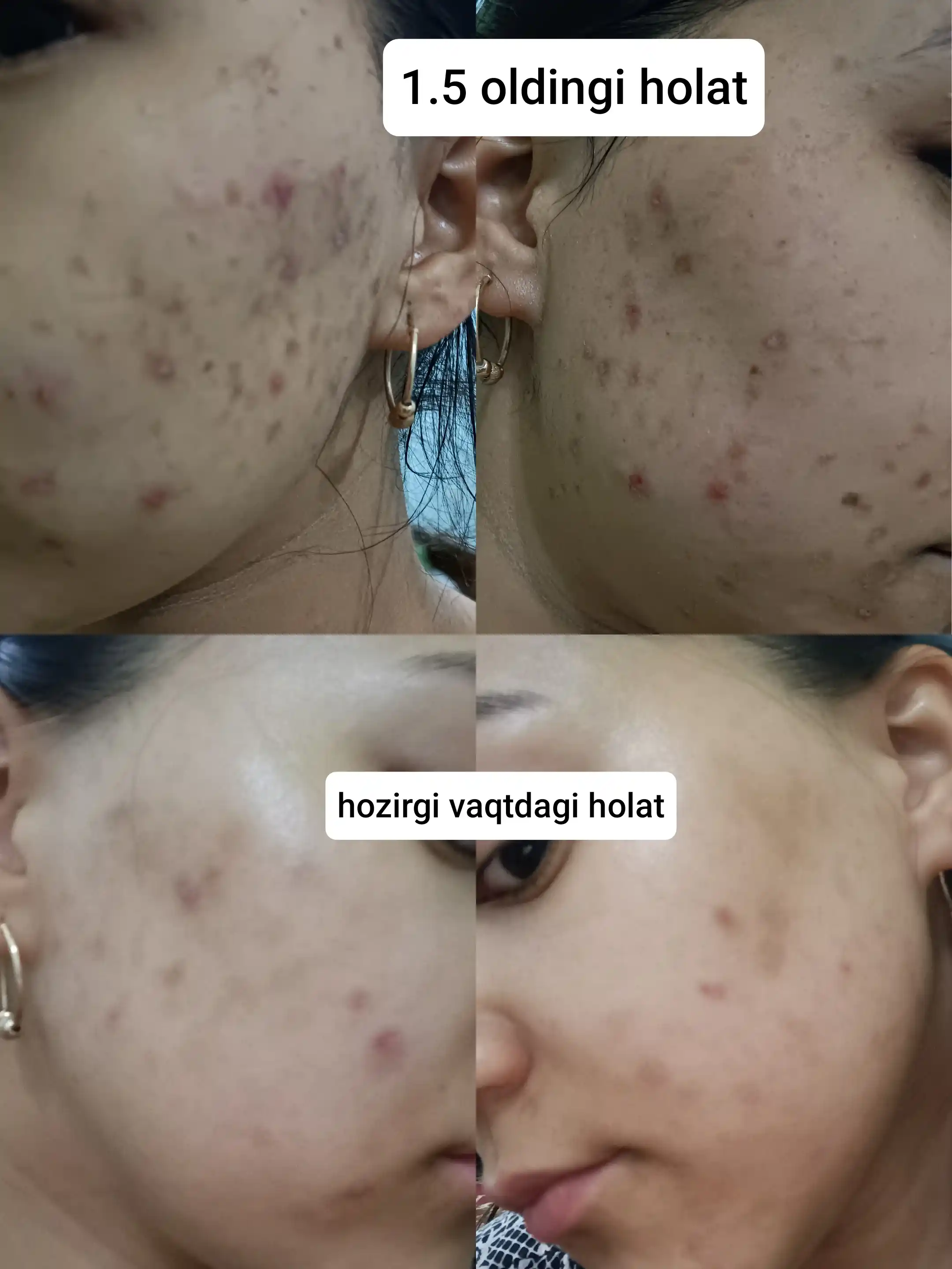 Восстанавливающий ночной крем для лица от пятен, Dr. Rashel Whitening Cream, 50 г
