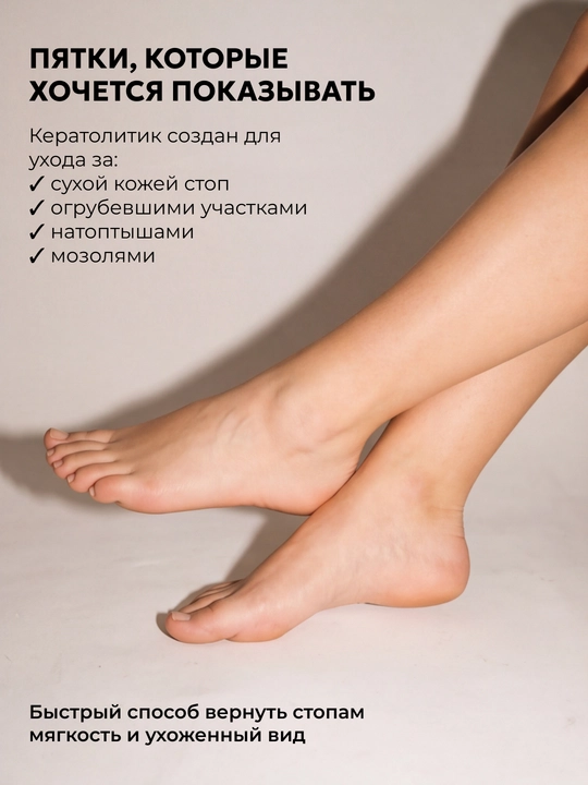 Кератолитик, жидкое лезвие для сухих пяток от трещин, пилинг для ног SEMILY, 400 мл
