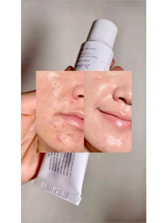 Dr. Althea 345 Relief Cream, 345 krem, yuz uchun krem, sezgir va muammoli teri uchun krem