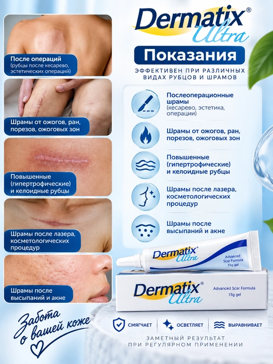 Гель от рубцов и шрамов Dermatix Ultra силиконовый с витамином C, 15 г