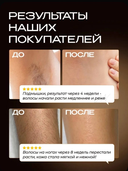 Babyverse Фотоэпилятор профессиональный, для лица и тела, с эффектом охлаждения