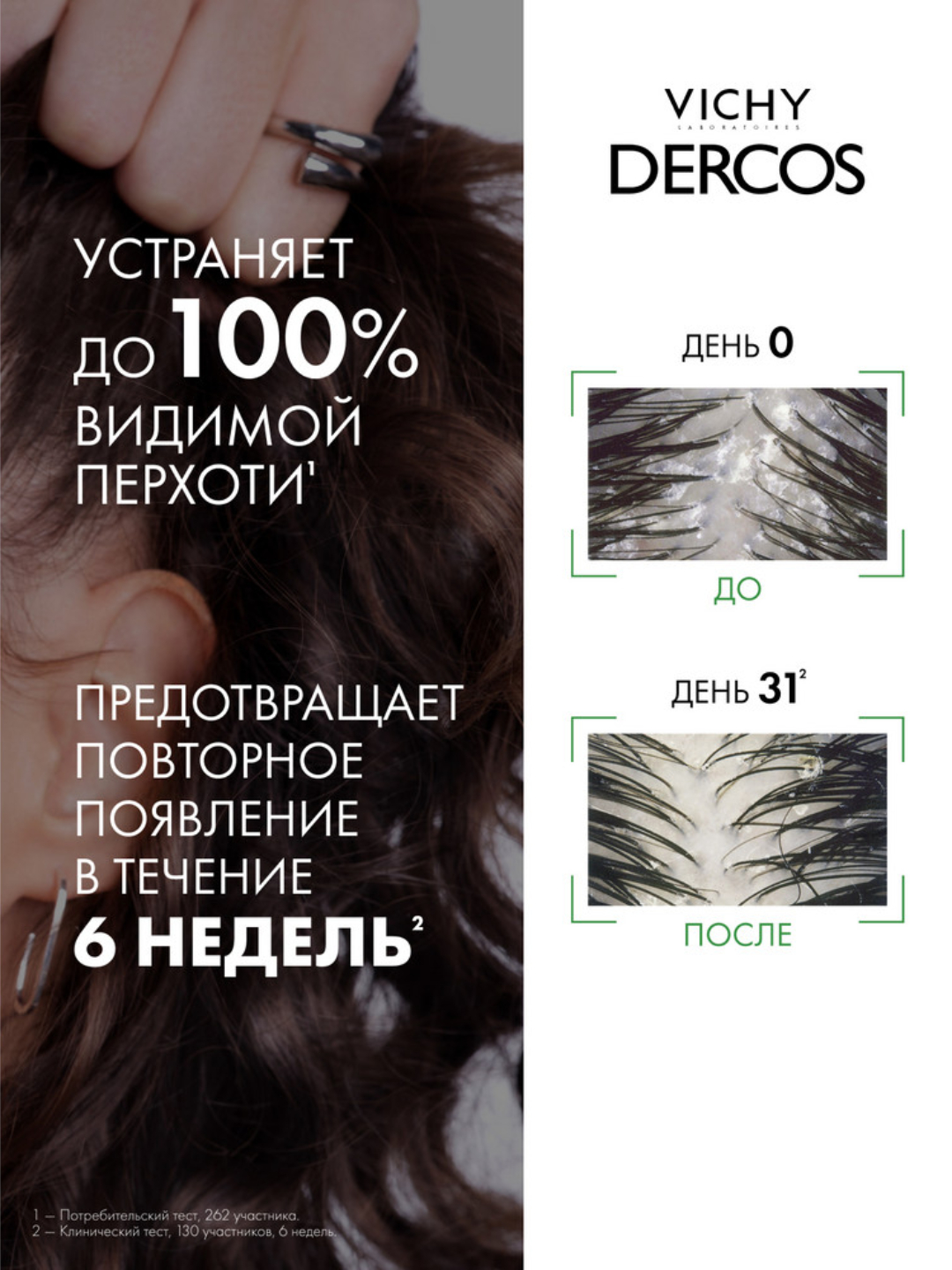Vichy Dercos Zichlik va yog‘li sochlar uchun kepekka qarshi intensiv parvarish-shampun, 390 ml