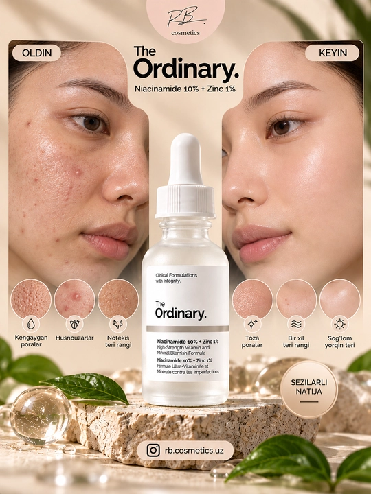 The Ordinary сыворотка Niacinamide 10% — против прыщей, сужает поры