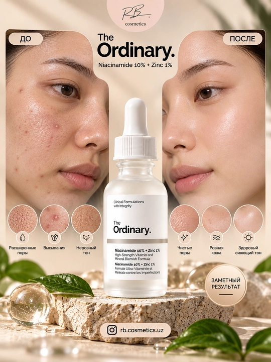 The Ordinary сыворотка Niacinamide 10% — против прыщей, сужает поры