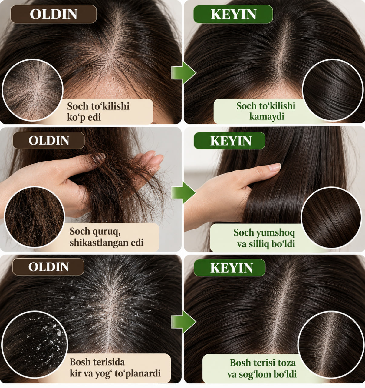 Argan moyi bilan soch to‘kilishiga qarshi shampun, 250 ml BIOAQUA Anti-Hair Loss Shampoo - 
