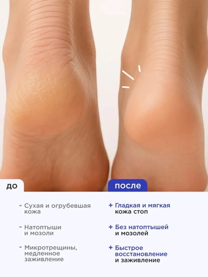 VOIS Крем для ног и пяток увлажняющий с мочевиной, 500 мл
