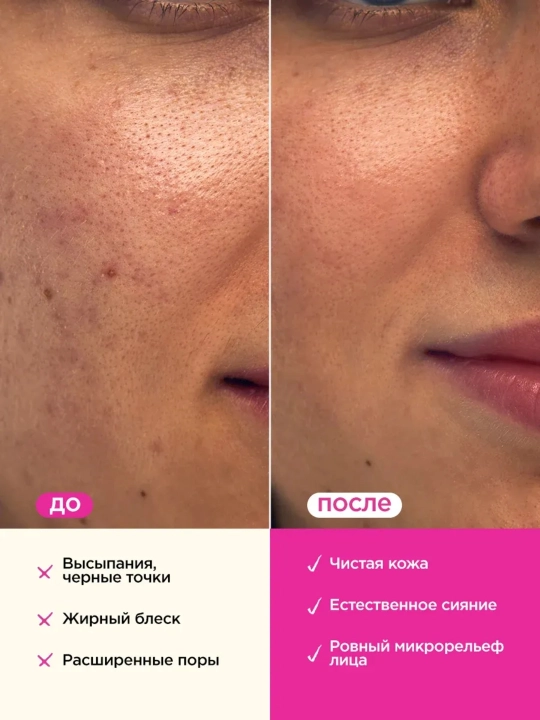 VOIS Yuz va tana uchun enzimli peeling kukuni, 220 ml
