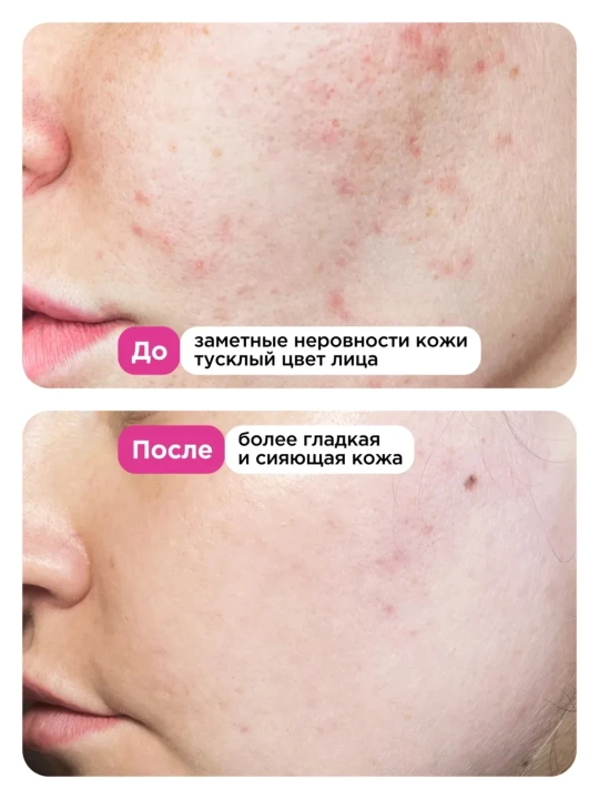 VOIS сыворотка для лица, 30 ml