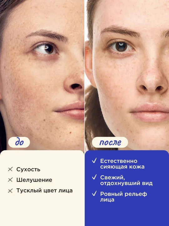 VOIS сыворотка для лица, 30 ml