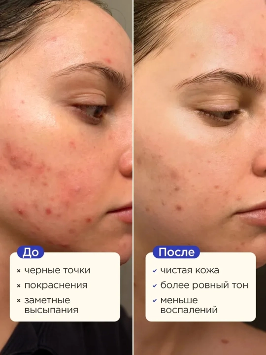 VOIS сыворотка для лица, 30 ml