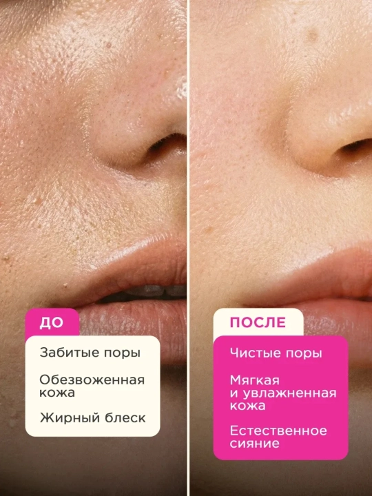 VOIS Гель-пенка для умывания лица увлажняющая очищающая 150 мл
