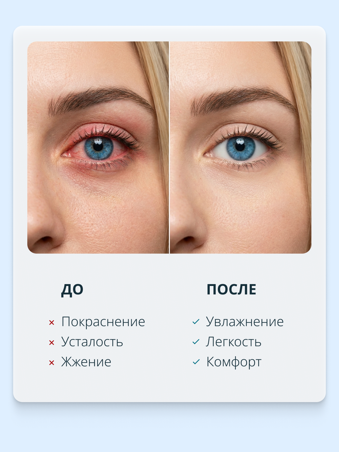 Увлажняющие капли для глаз RELINS с L-карнитином и L-ментолом (Германия + Беларусь), 10 мл