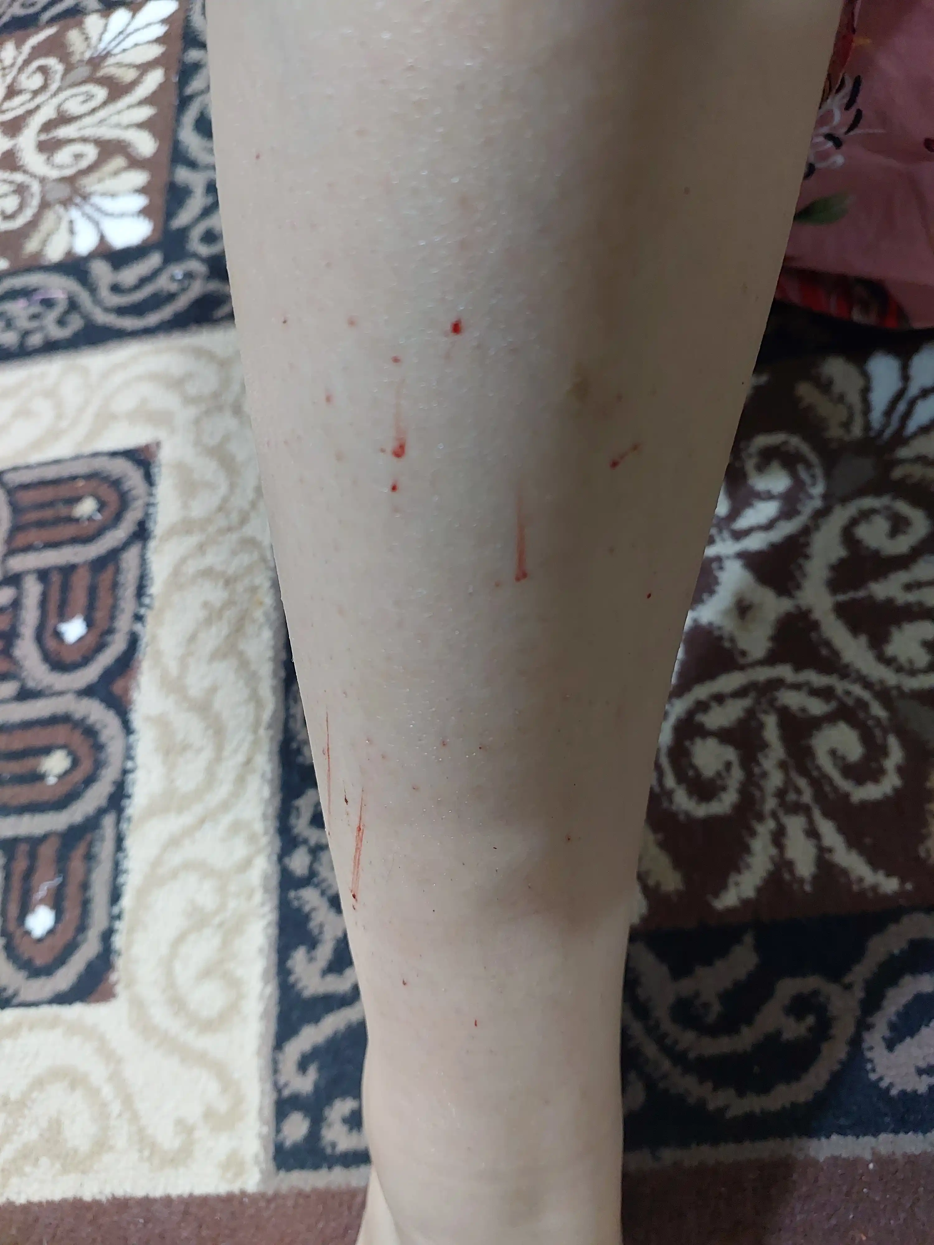 Qayta foydalanish mumkin bo'lgan ayollar ustarasi, Aloe Vera, 5 pichoqli
