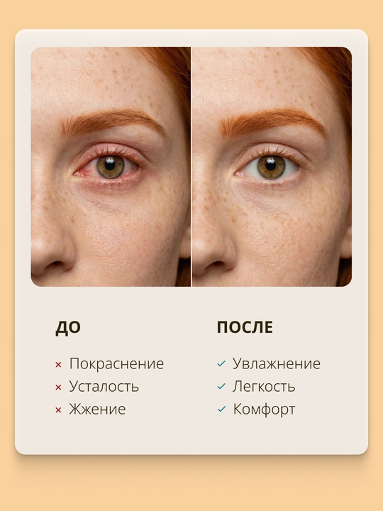 Vitaminli RELINS ko‘z namlovchi tomchilari (Germaniya + Belarus), 10 ml