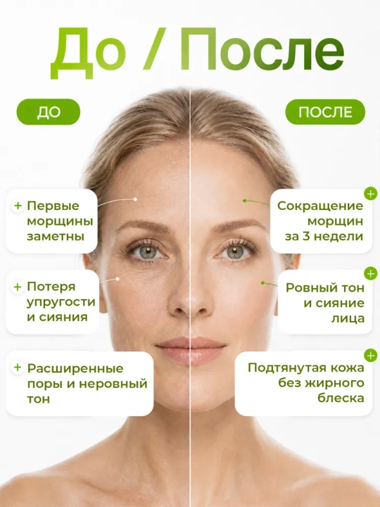 SPICULE Booster kremi, MIXIT dan mikroigna va retinolli yuz kremi, 15 ml