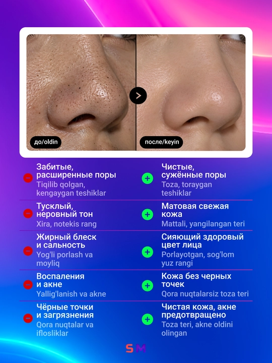 Вакуумный аппарат очиститель пор, для кожи лица, от чёрных точек