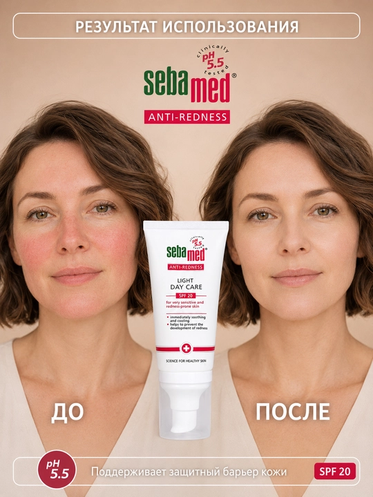 Крем дневной Sebamed Anti-Redness Light Day Care SPF 20 против покраснений